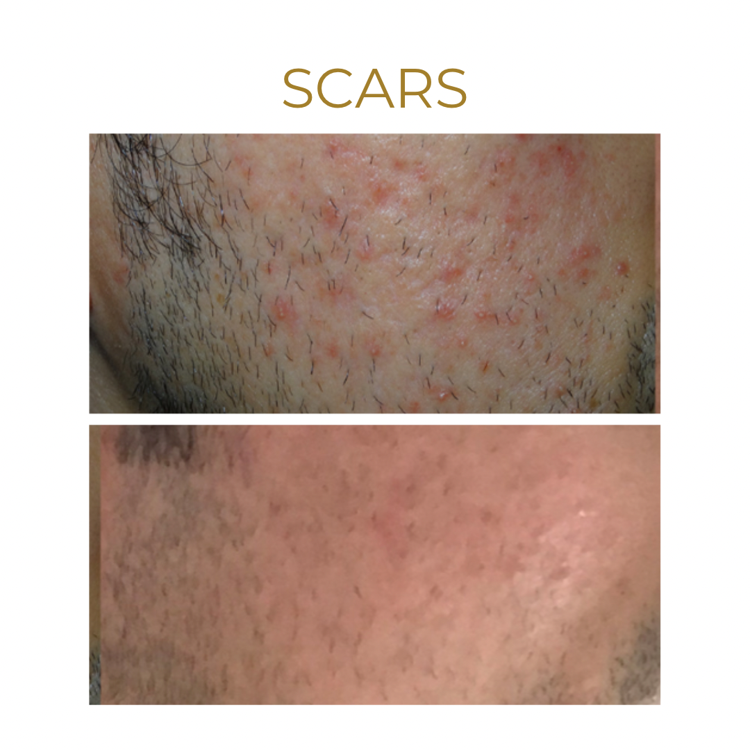 we are so excited about this new treatment... heres why 👉 - 4