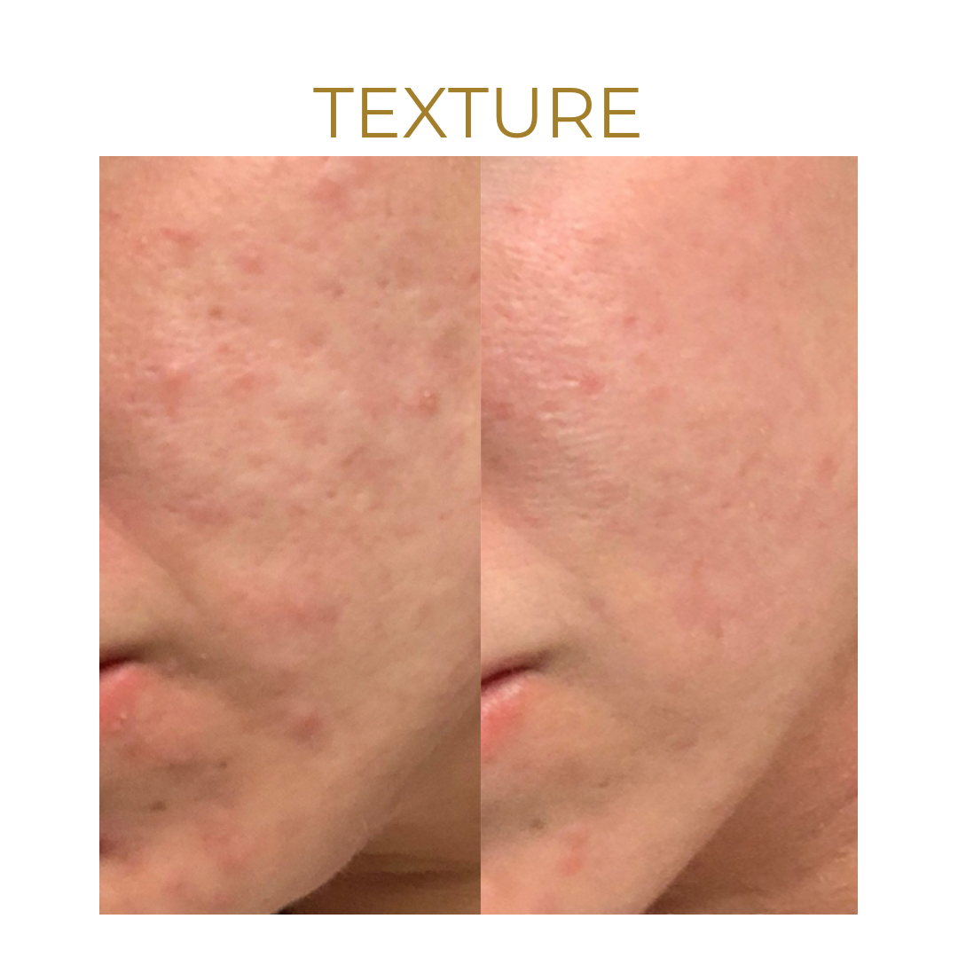 we are so excited about this new treatment... heres why 👉 - 5
