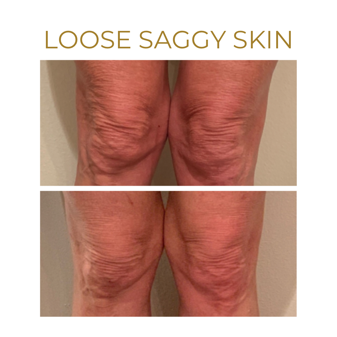 we are so excited about this new treatment... heres why 👉 - 6