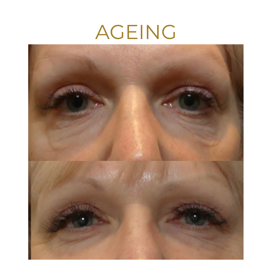 we are so excited about this new treatment... heres why 👉 - 7