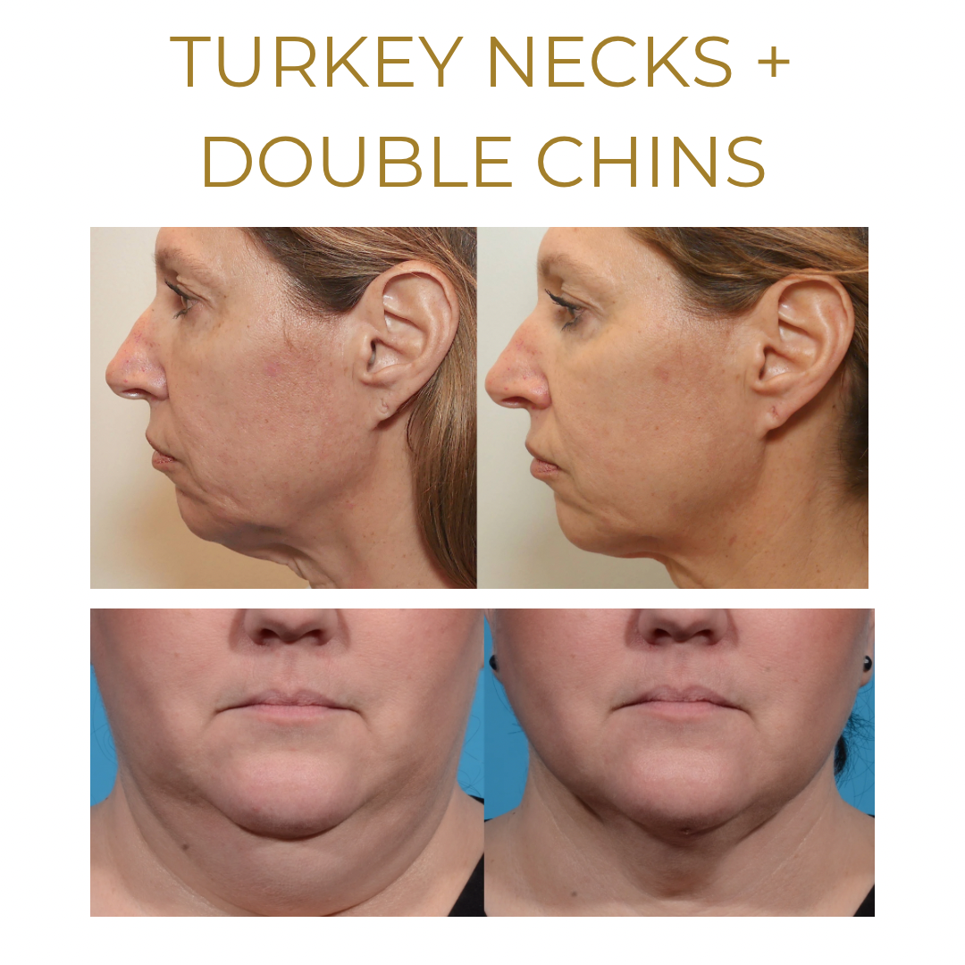we are so excited about this new treatment... heres why 👉 - 8